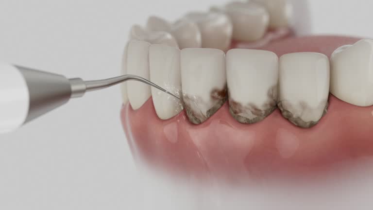 Trusted Dental Implants service in Mallory, WV - Dentist Open Now